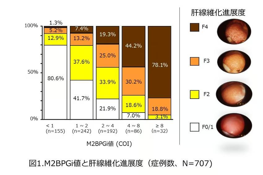 肝臓の線維化の進行を示す図